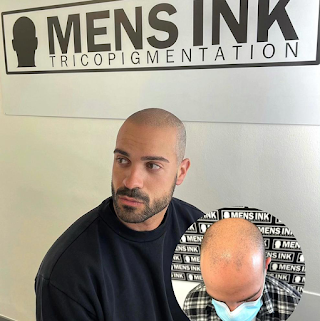 Men's Ink Tricopigmentazione