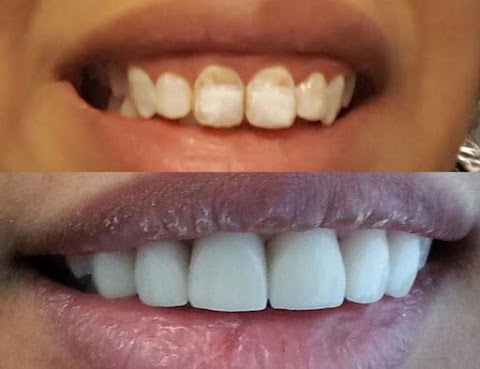 Studio Odontoiatrico Pareschi | Dentista a Portomaggiore