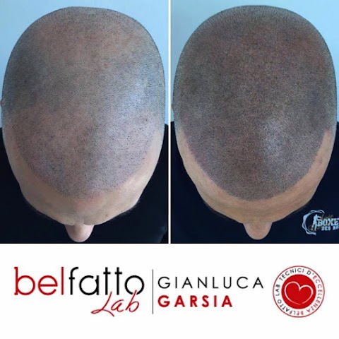 Gianluca Garsia: Tricopigmentazione Roma e tatuaggio capelli