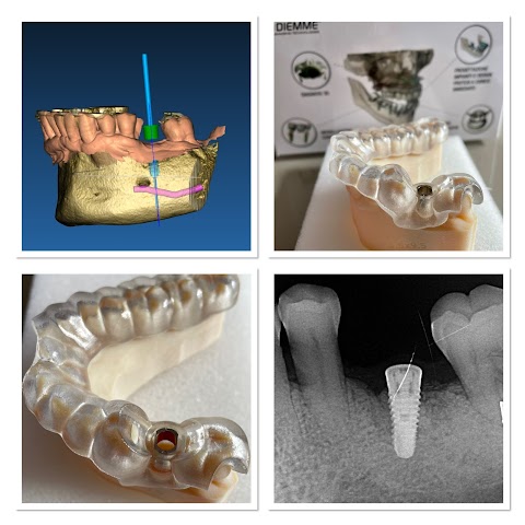 CMO Centro di Microscopia Odontoiatria Dr. Ianniciello Luigi