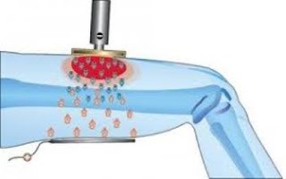 Fisioterapia- posturologia- tecarterapia della Dott.ssa Giuseppina Fassari