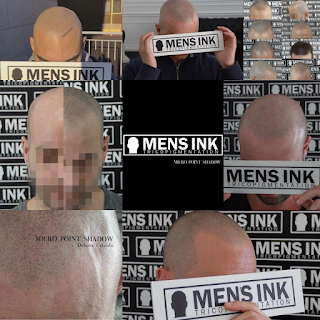 Men's Ink Tricopigmentazione
