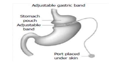 Dott. Gennaro Martines, Chirurgo generale,chirurgo bariatrico,proctologo, chirurgia laparoscopica,chirurgia colo-rettale,endoscopia digestiva diagnostica e operativa