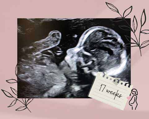 Meet Your Miracle Ultrasound Studio Coventry