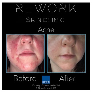 ReWork Skin Clinic