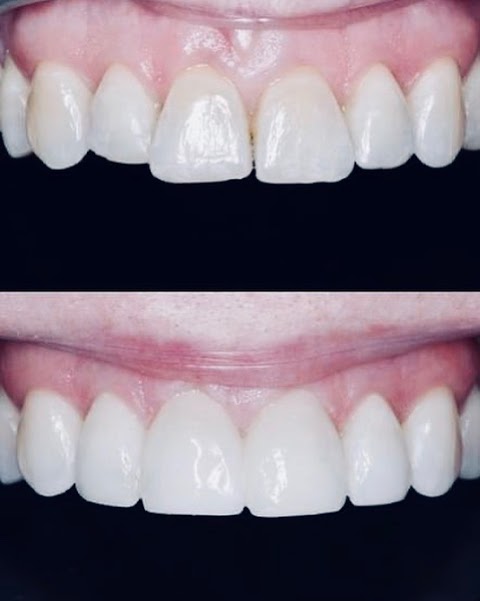 Sloan Dental Carfin