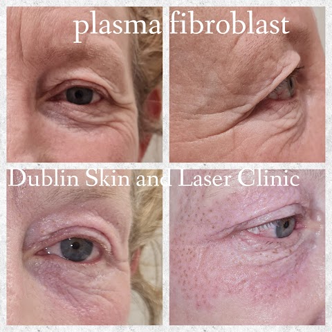 Dublin Skin and Laser Clinic
