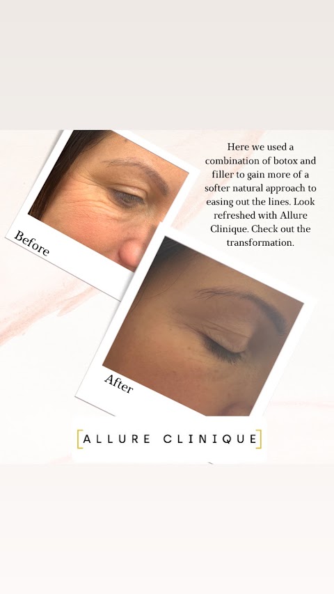 Allure Clinique