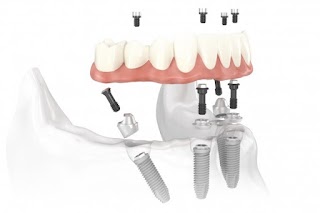 Dental Solutions