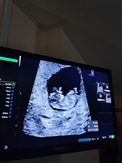 Cherish-UK Ultrasound Scans