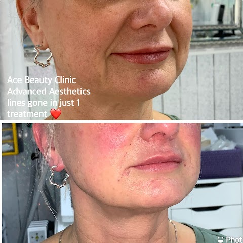 Ace Beauty Clinic Advanced Aesthetics