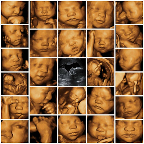 Miracle Inside 3D/4D Baby Scan Centre