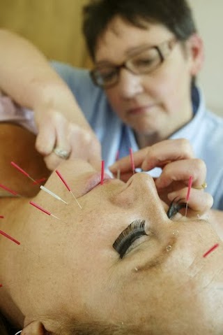 Facial Enhancement, Medical Acupuncture and Hypnotherapy