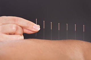 Acu Room - Acupuncture and Wellness Clinic