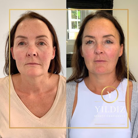 Yildiz Beauty Confidence | Anti Ageing Aesthetic Clinic