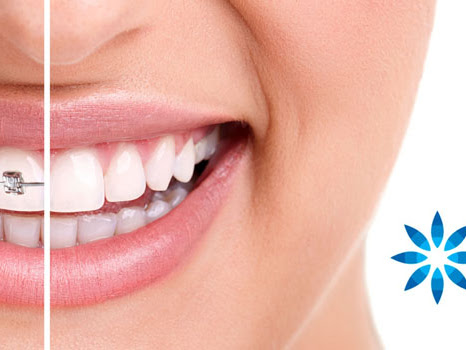 Buxton Dental Practice - Invisalign & Implant Dentistry