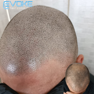 Evoke Hair Clinic