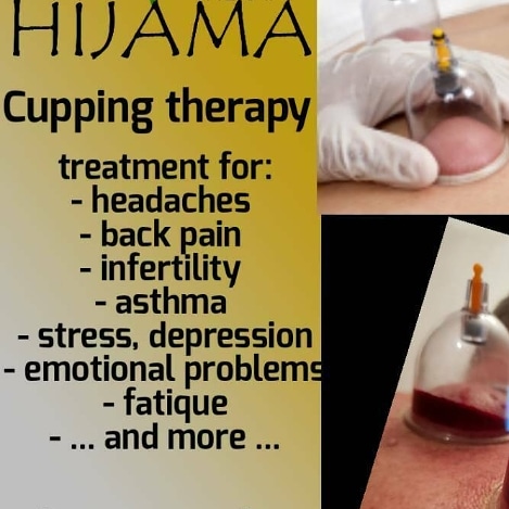 Hijama cupping manchester for women only