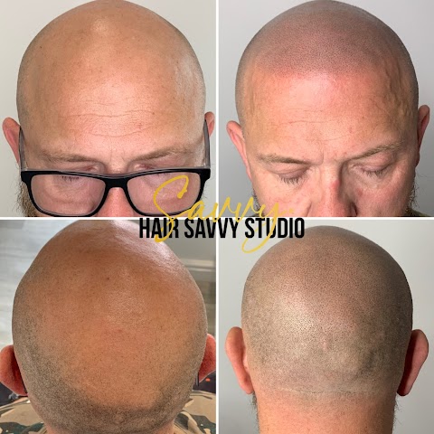 Hair Savvy Studio - Scalp Micropigmentation Clinic