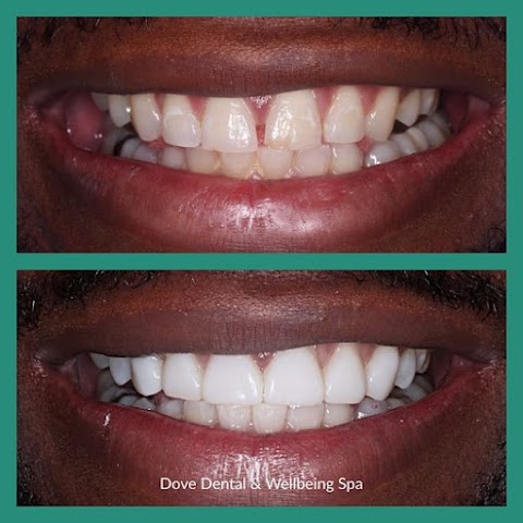 Dove Dental & Wellbeing Spa | Dentist Earlsfield