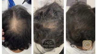 Southampton Hair Loss Clinic