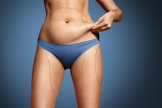 London Liposuction Clinic