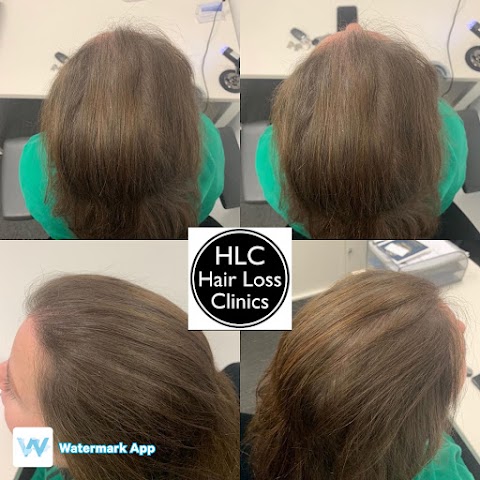 Hair Loss Clinic