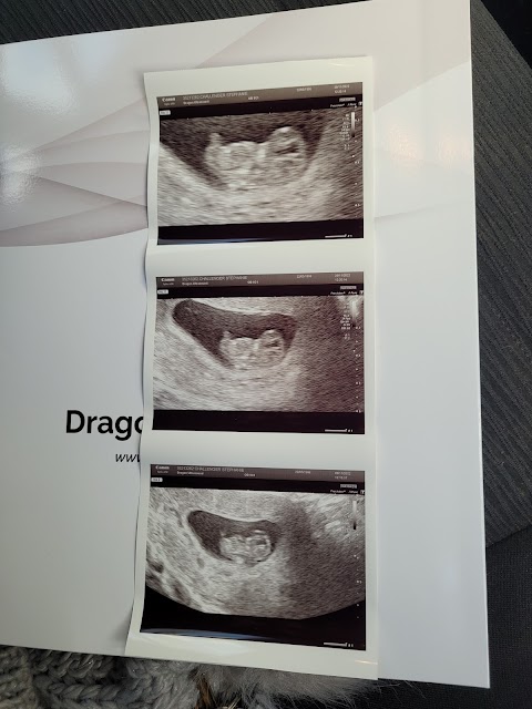 Dragon Ultrasound