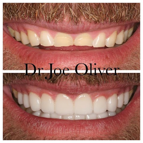 Dr Joe Oliver - Cosmetic Dentist Manchester Clinic