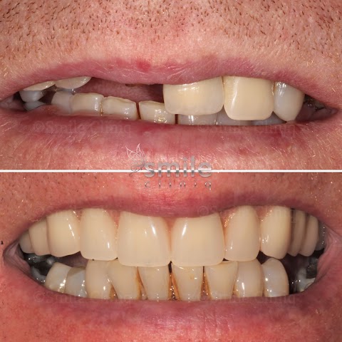 Smile Cliniq - St Johns Wood