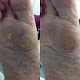 Photo of Foot Clinic Acocks Green - 1170 Warwick Road, Acocks Green, Birmingham B27 6BS, United Kingdom