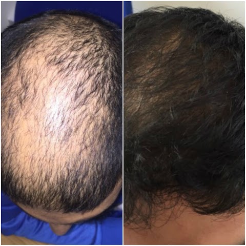 The Hair Loss Clinic