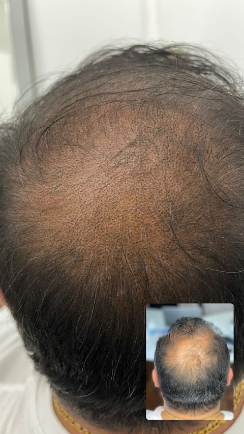 The Hair Tattoo Clinic - Non Surgical Hair Replacement