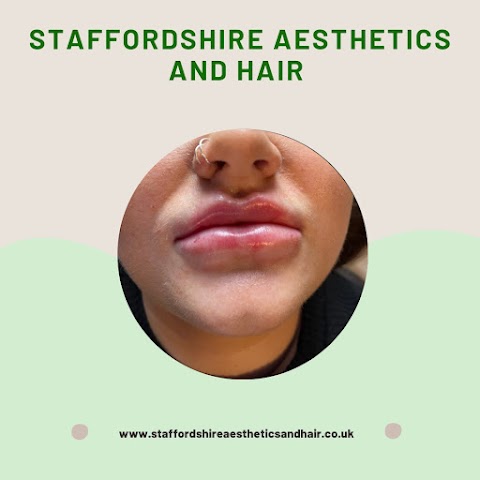 Staffordshire Aesthetics and Hair