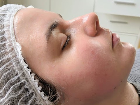 Infinite Beauty Aesthetics - Lip Fillers | Botox | Fat Dissolve