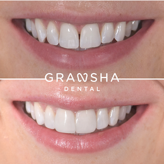 Gransha Dental Surgery