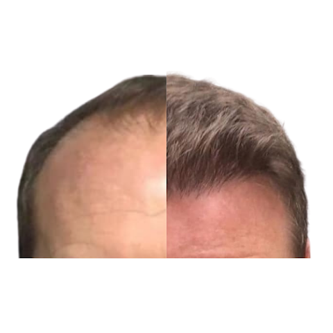 Hair Loss Studio