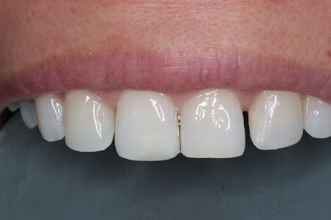 Smile NW Dental Practice
