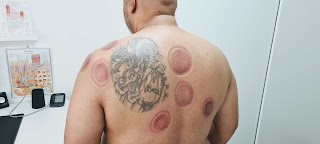 Mubarak Cupping Therapy