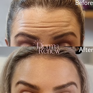 DermaRenew Aesthetics