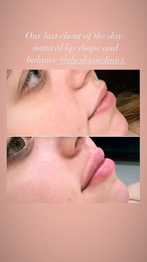 The Sloan Clinics- Dermal fillers and Skin Health Clinic