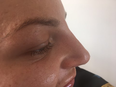 Perfect Aesthetics | Advanced Botox & Lip Fillers Plymouth