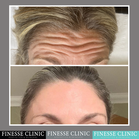 Finesse Clinic - Medical Aesthetics & Skincare