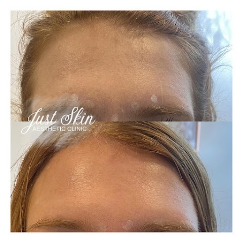 Just Skin Aesthetic Clinic