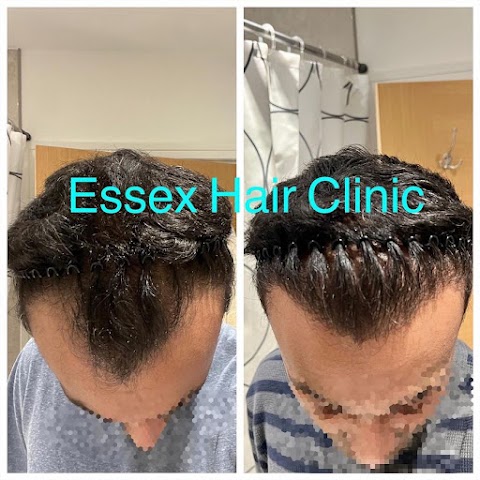 Essex Hair Clinic