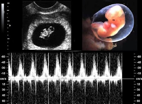 Ultrasound Direct Southampton - Babybond