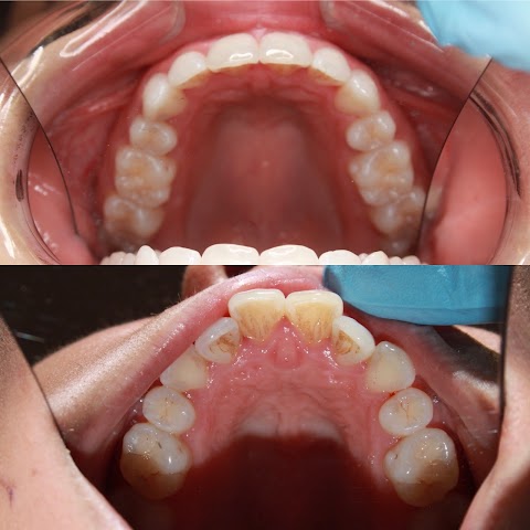 Dental22