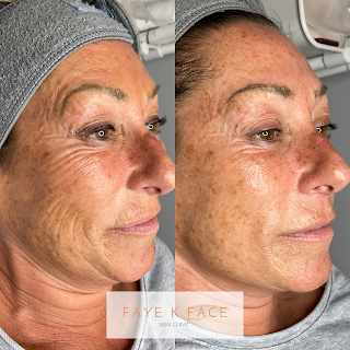 Faye K Face Skin Clinic