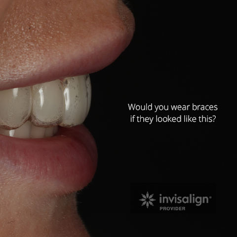 Dr Tom Lotka - Invisalign Sheffield