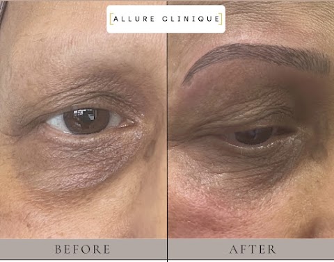 Allure Clinique